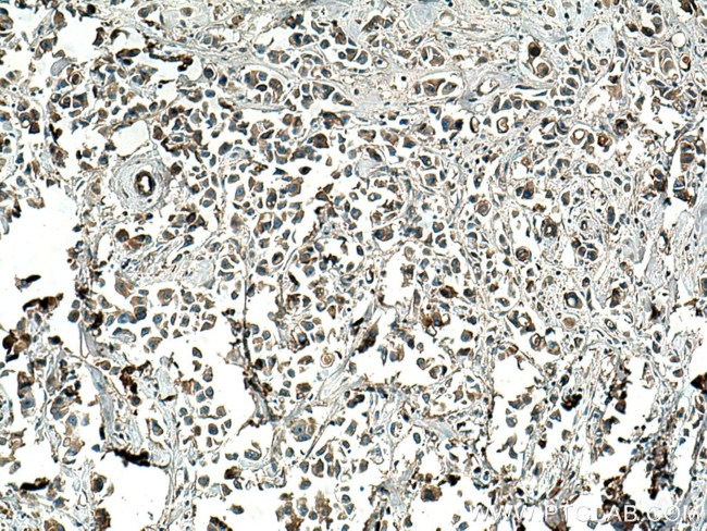 SLC25A1 Antibody in Immunohistochemistry (Paraffin) (IHC (P))