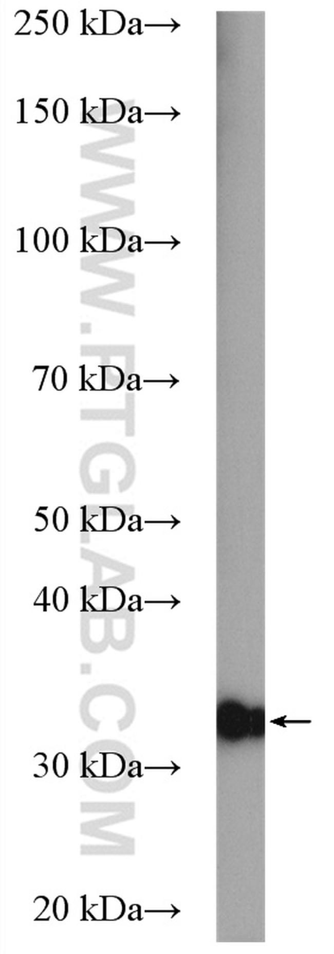 SLC25A1 Antibody in Western Blot (WB)