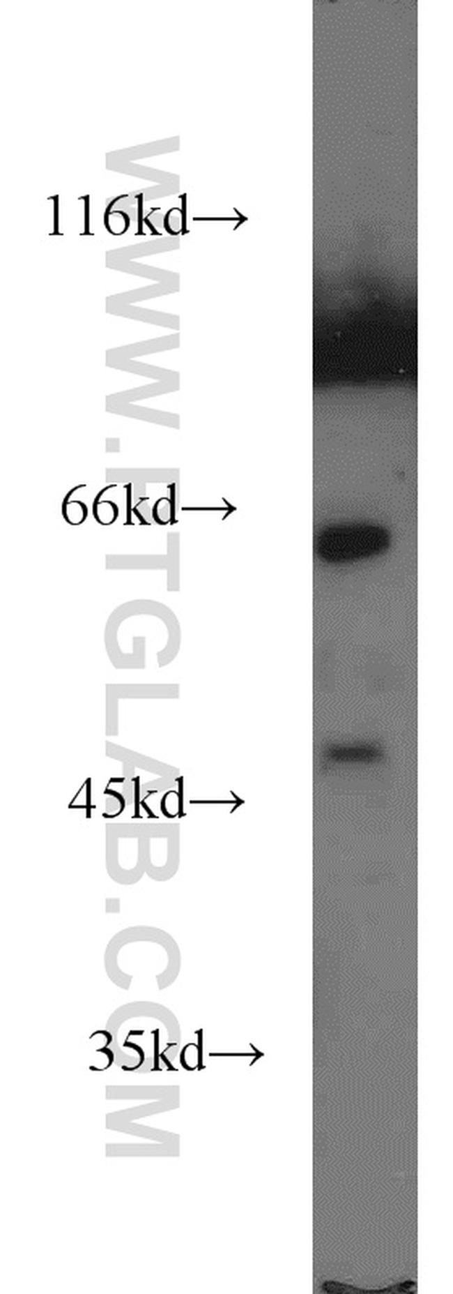 ACP2 Antibody in Western Blot (WB)