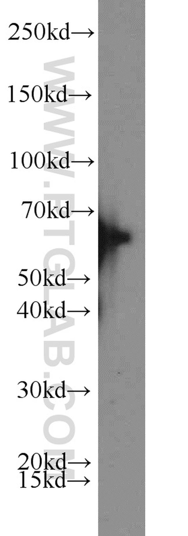 ACP2 Antibody in Western Blot (WB)