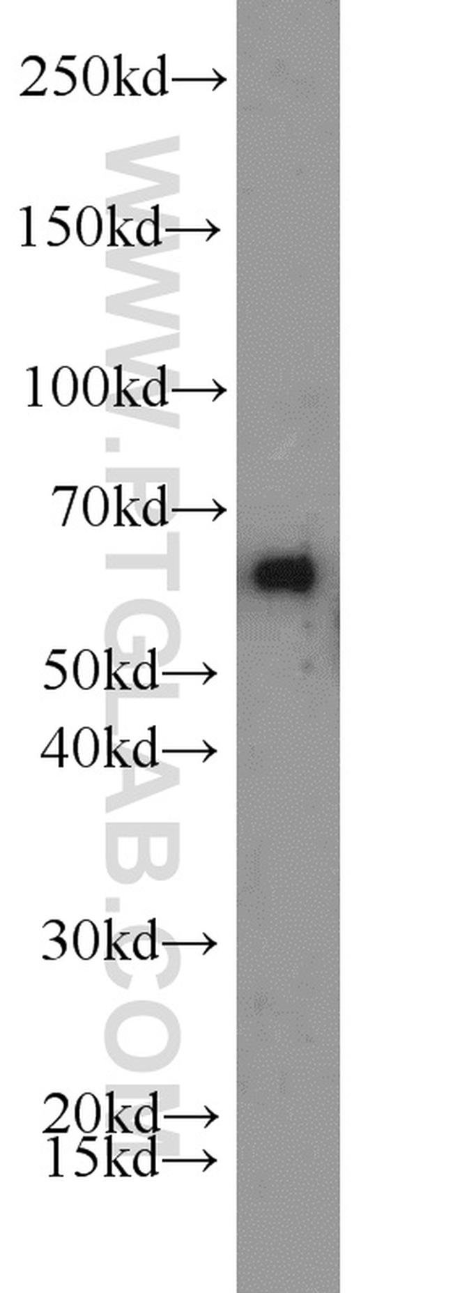 ACP2 Antibody in Western Blot (WB)