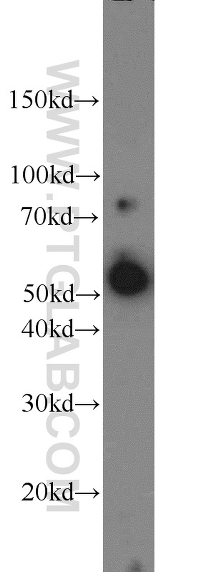 ACP2 Antibody in Western Blot (WB)