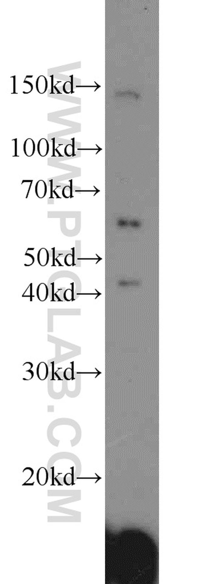 ACP2 Antibody in Western Blot (WB)