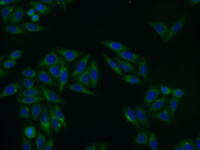 ACP2 Antibody in Immunocytochemistry (ICC/IF)