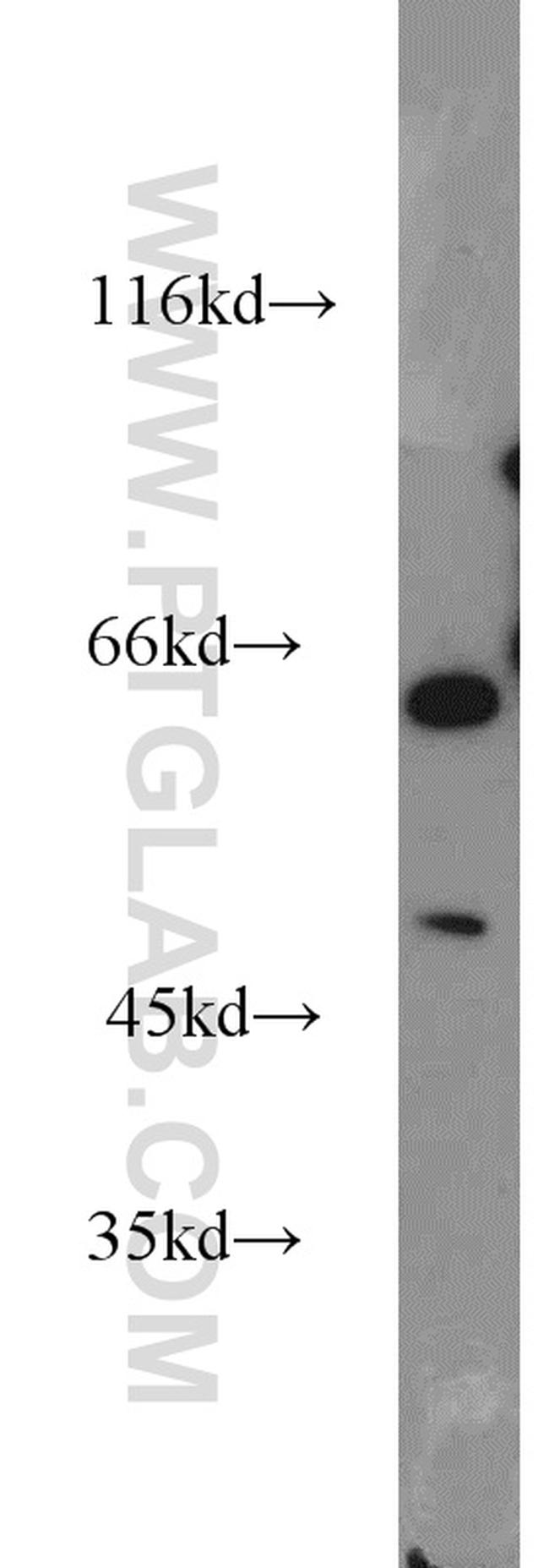 ACP2 Antibody in Western Blot (WB)