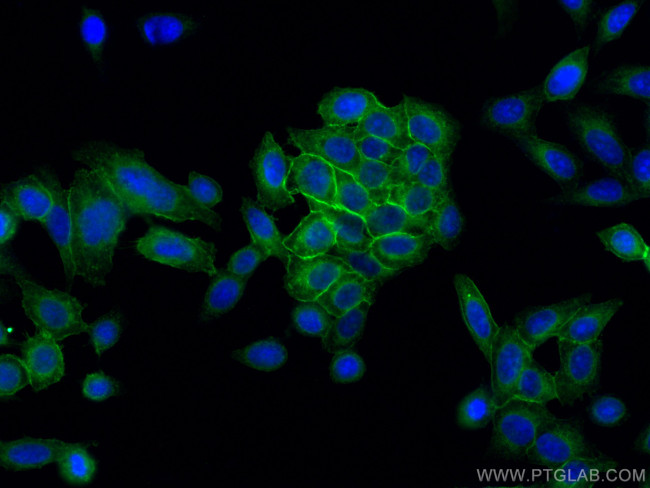 HLA class I ABC Antibody in Immunocytochemistry (ICC/IF)