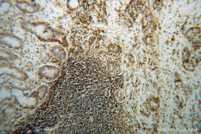 HLA class I ABC Antibody in Immunohistochemistry (Paraffin) (IHC (P))