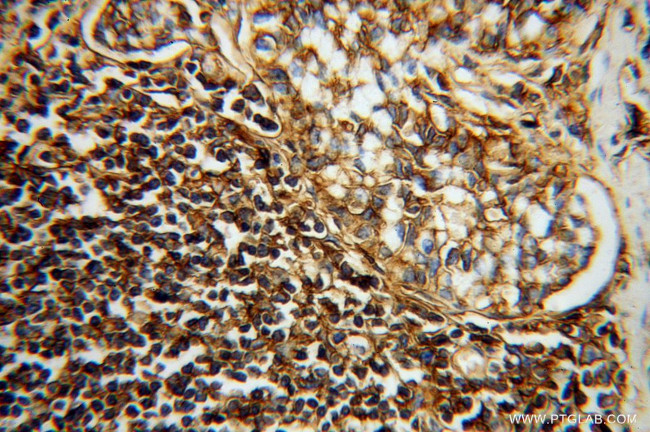 HLA class I ABC Antibody in Immunohistochemistry (Paraffin) (IHC (P))