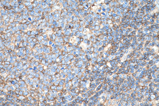 HLA class I ABC Antibody in Immunohistochemistry (Paraffin) (IHC (P))