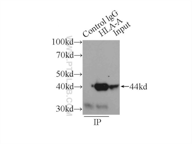 HLA class I ABC Antibody in Immunoprecipitation (IP)