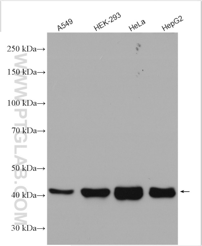 HLA class I ABC Antibody in Western Blot (WB)