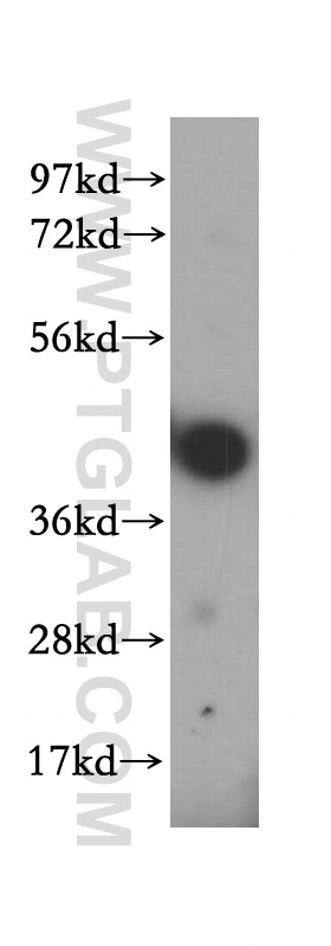 HLA class I ABC Antibody in Western Blot (WB)