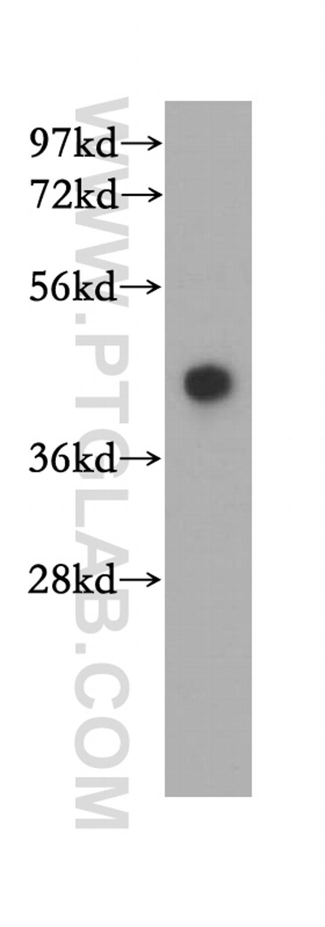 HLA class I ABC Antibody in Western Blot (WB)