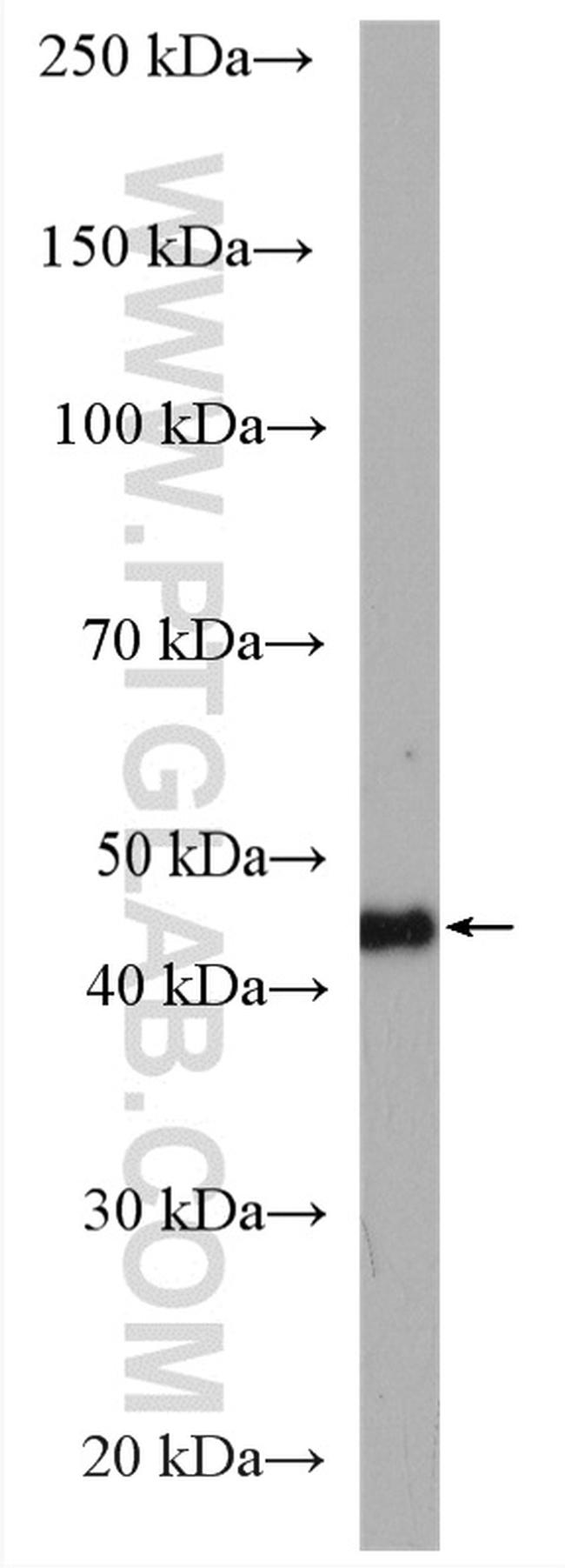 HLA class I ABC Antibody in Western Blot (WB)