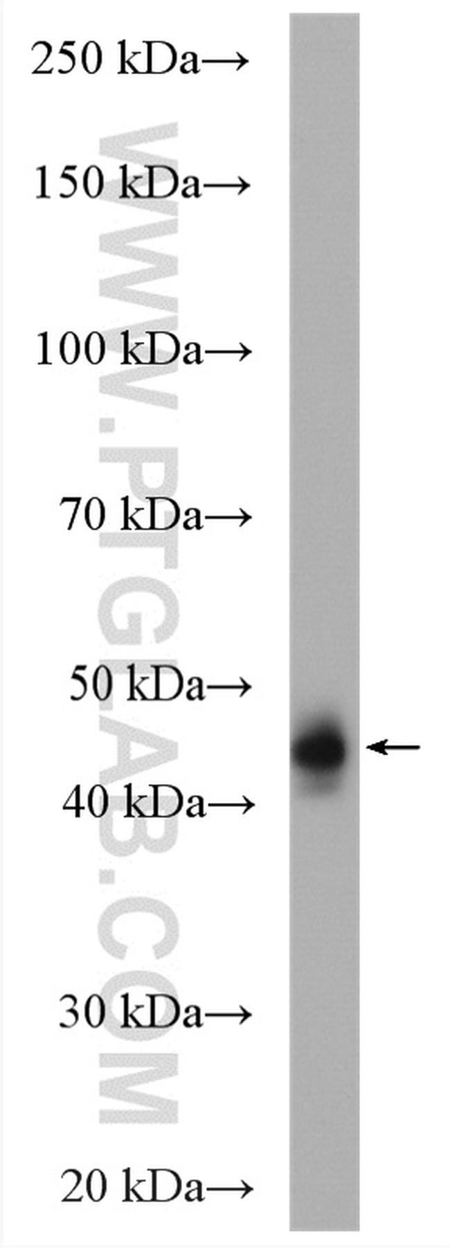 HLA class I ABC Antibody in Western Blot (WB)