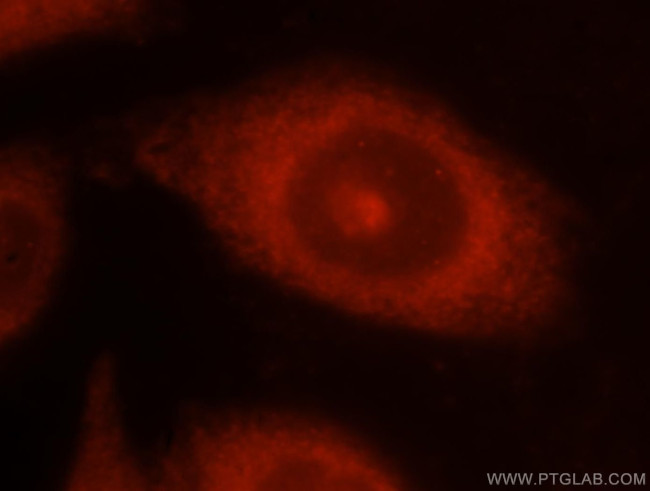 NCK1 Antibody in Immunocytochemistry (ICC/IF)