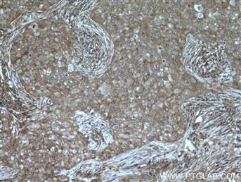 NCK1 Antibody in Immunohistochemistry (Paraffin) (IHC (P))