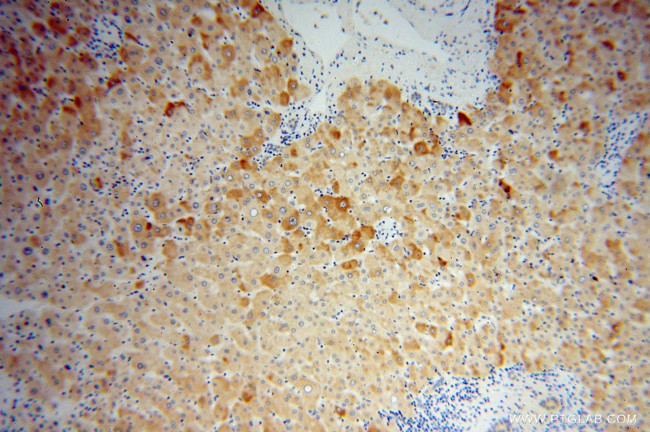 GEMIN8 Antibody in Immunohistochemistry (Paraffin) (IHC (P))