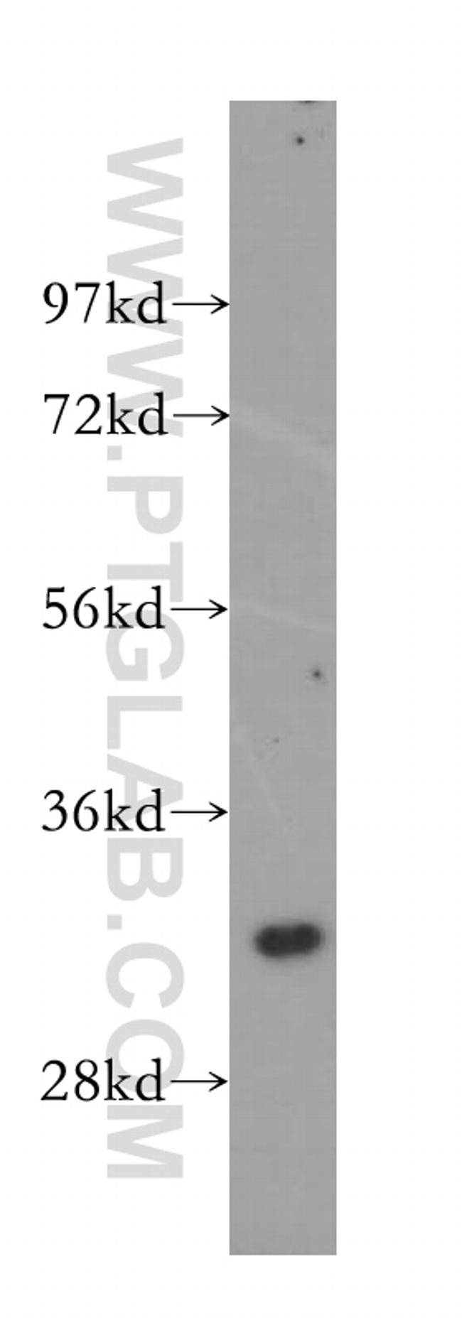 GEMIN8 Antibody in Western Blot (WB)