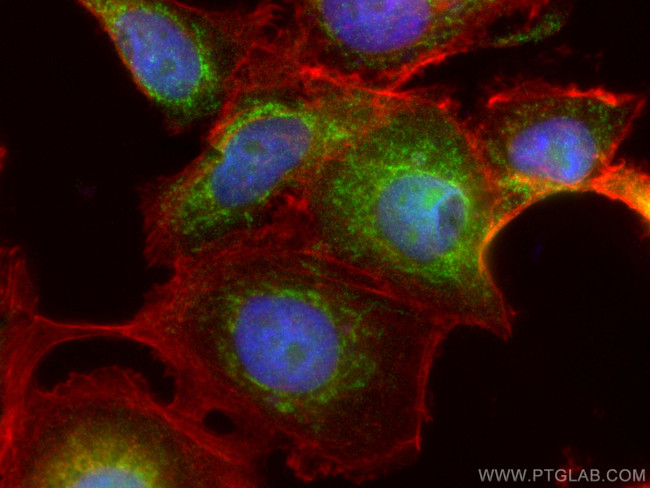 MAGED2 Antibody in Immunocytochemistry (ICC/IF)