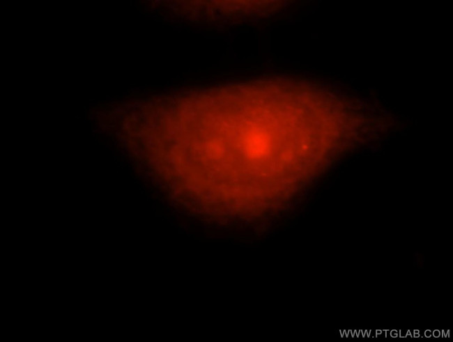 MAGED2 Antibody in Immunocytochemistry (ICC/IF)