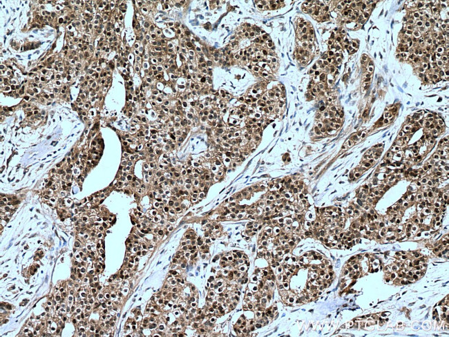 MAGED2 Antibody in Immunohistochemistry (Paraffin) (IHC (P))