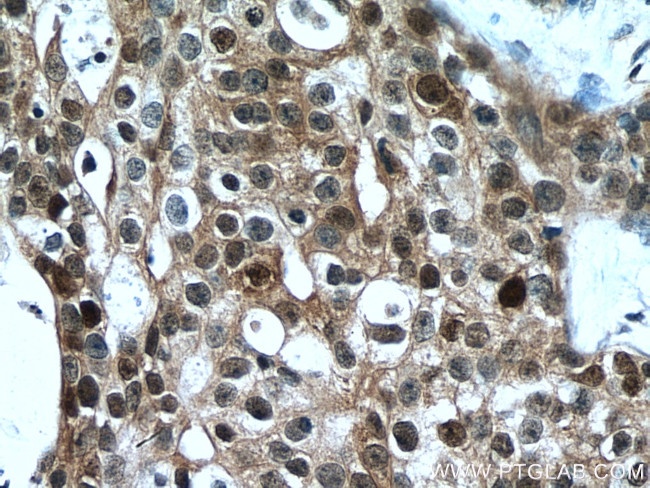 MAGED2 Antibody in Immunohistochemistry (Paraffin) (IHC (P))