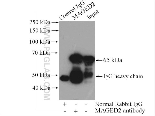 MAGED2 Antibody in Immunoprecipitation (IP)