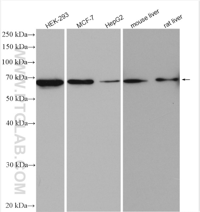 MAGED2 Antibody in Western Blot (WB)