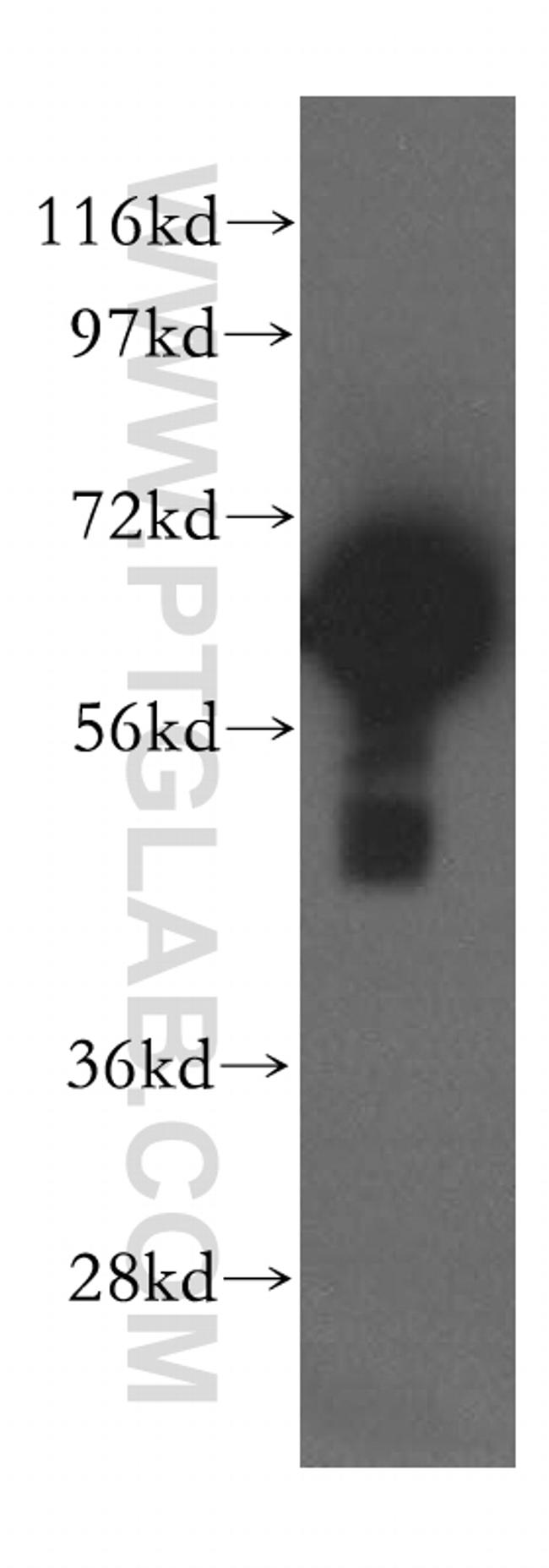 MAGED2 Antibody in Western Blot (WB)