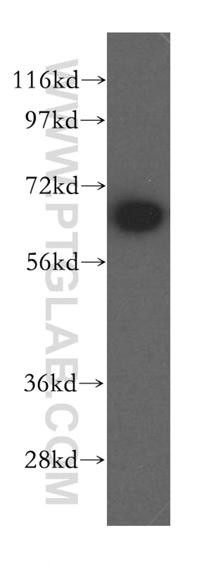 MAGED2 Antibody in Western Blot (WB)