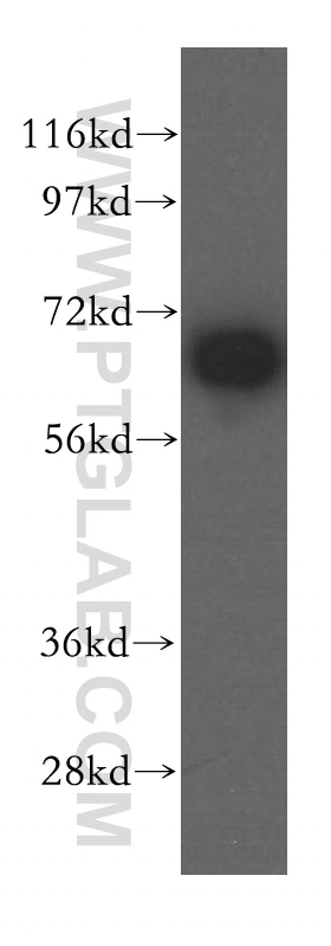 MAGED2 Antibody in Western Blot (WB)