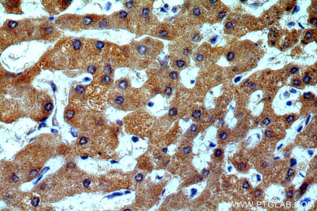 H6PD Antibody in Immunohistochemistry (Paraffin) (IHC (P))