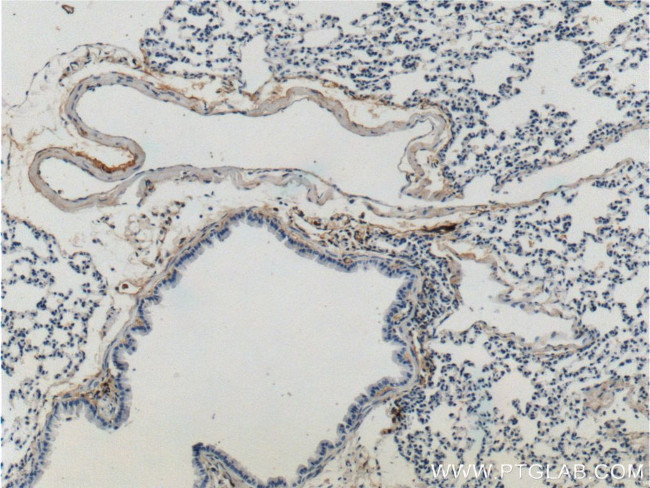 Elastin Antibody in Immunohistochemistry (Paraffin) (IHC (P))