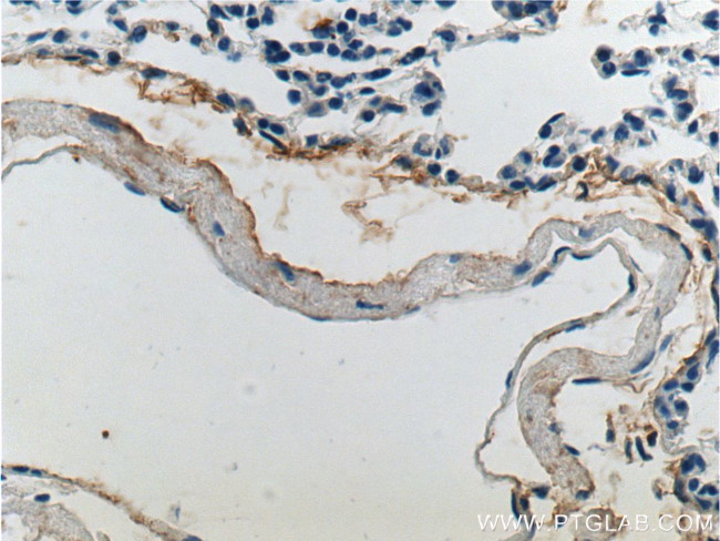 Elastin Antibody in Immunohistochemistry (Paraffin) (IHC (P))