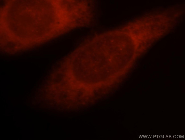 PSMD13 Antibody in Immunocytochemistry (ICC/IF)