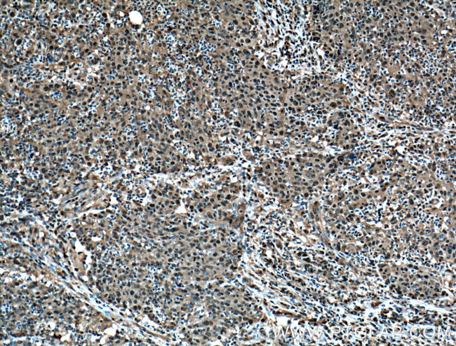 PSMD13 Antibody in Immunohistochemistry (Paraffin) (IHC (P))