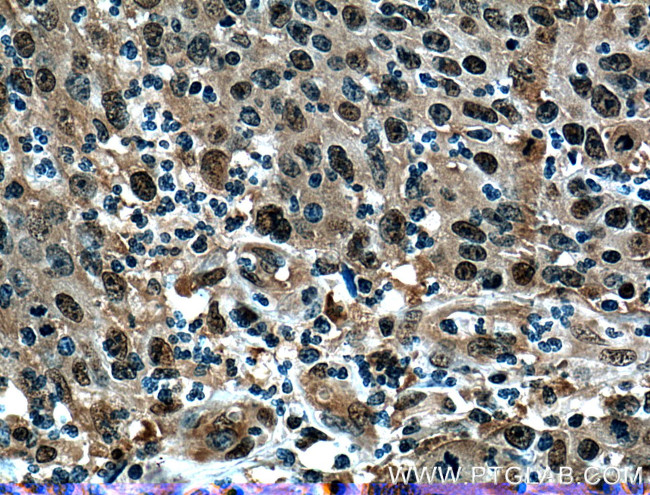 PSMD13 Antibody in Immunohistochemistry (Paraffin) (IHC (P))