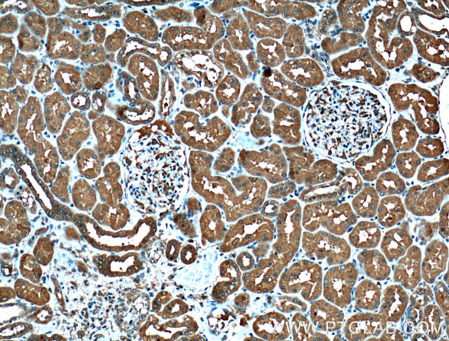 PSMD13 Antibody in Immunohistochemistry (Paraffin) (IHC (P))