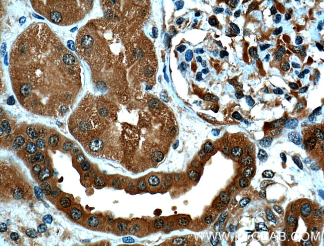 PSMD13 Antibody in Immunohistochemistry (Paraffin) (IHC (P))