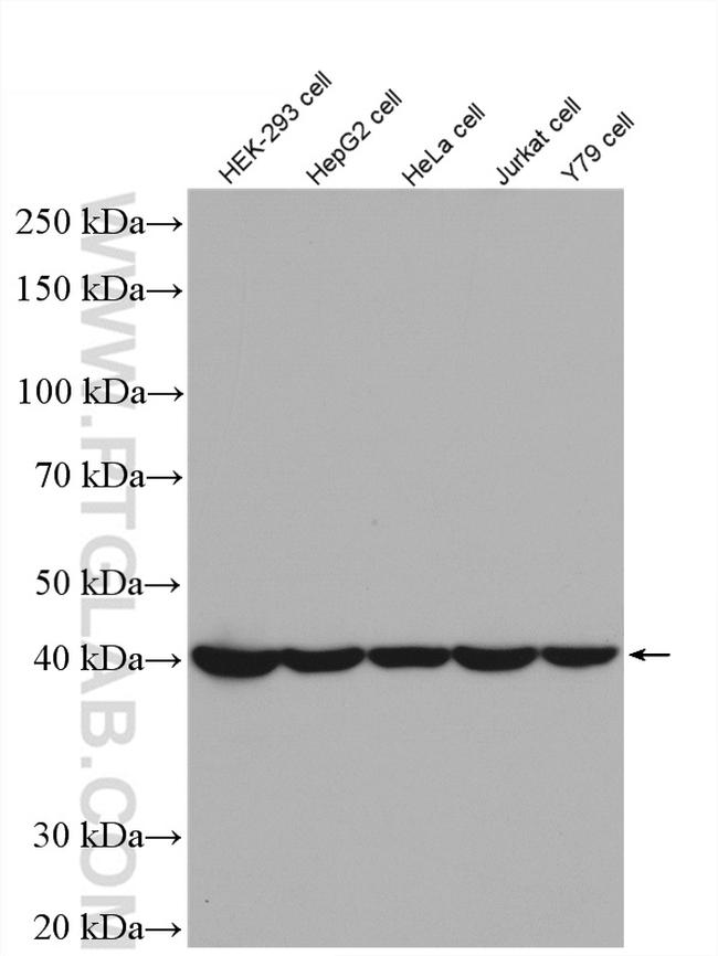 PSMD13 Antibody in Western Blot (WB)