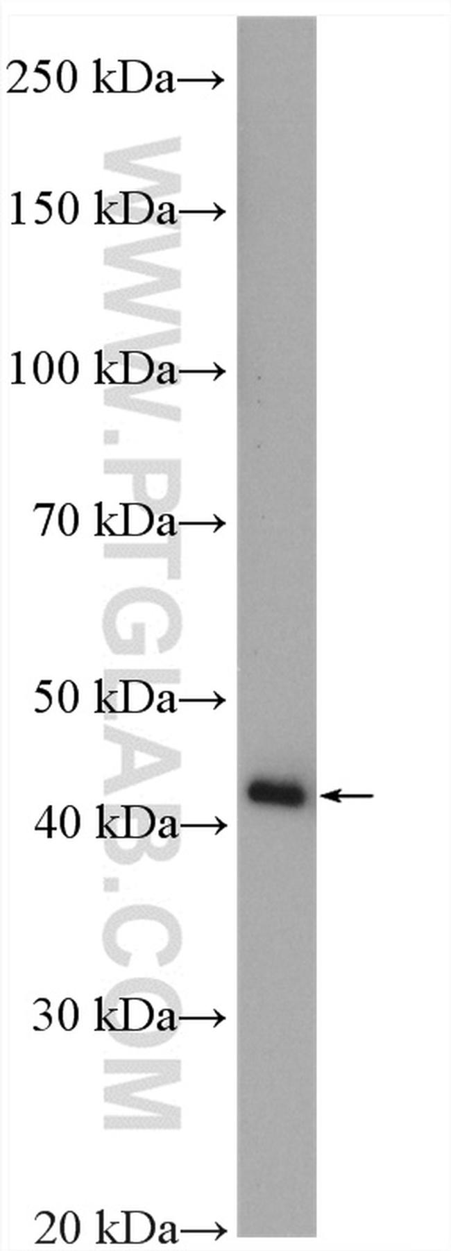 PSMD13 Antibody in Western Blot (WB)