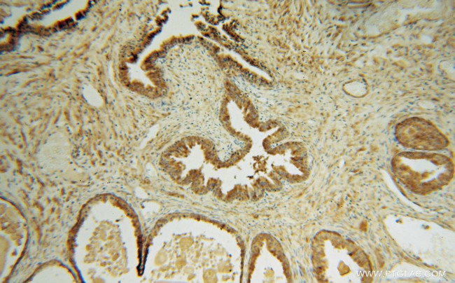 TMOD2 Antibody in Immunohistochemistry (Paraffin) (IHC (P))