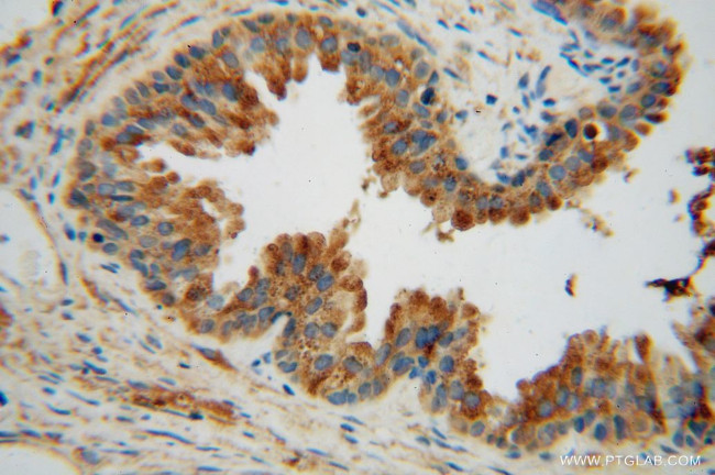 TMOD2 Antibody in Immunohistochemistry (Paraffin) (IHC (P))