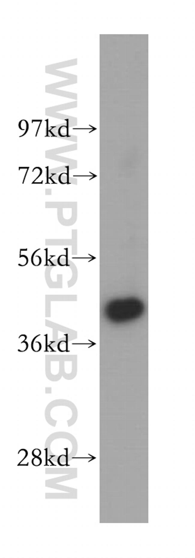 TMOD2 Antibody in Western Blot (WB)