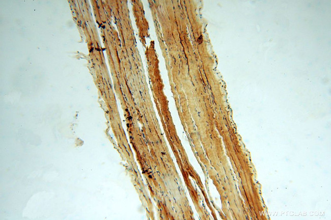 KIF1B Antibody in Immunohistochemistry (Paraffin) (IHC (P))