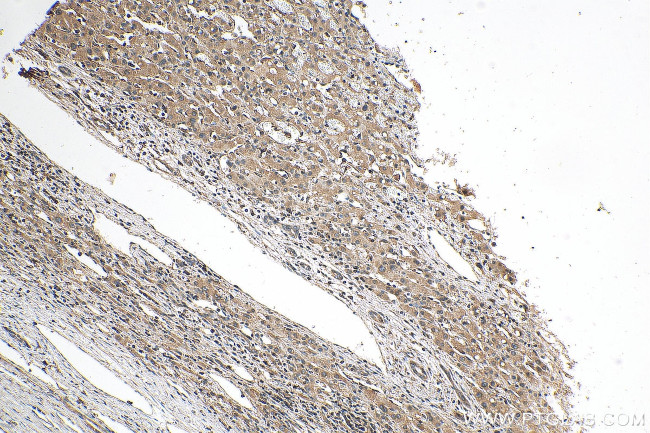 KIF1B Antibody in Immunohistochemistry (Paraffin) (IHC (P))