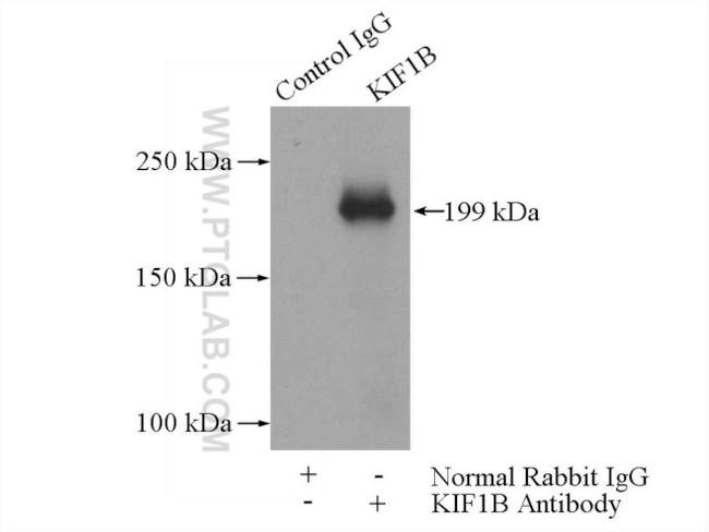 KIF1B Antibody in Immunoprecipitation (IP)