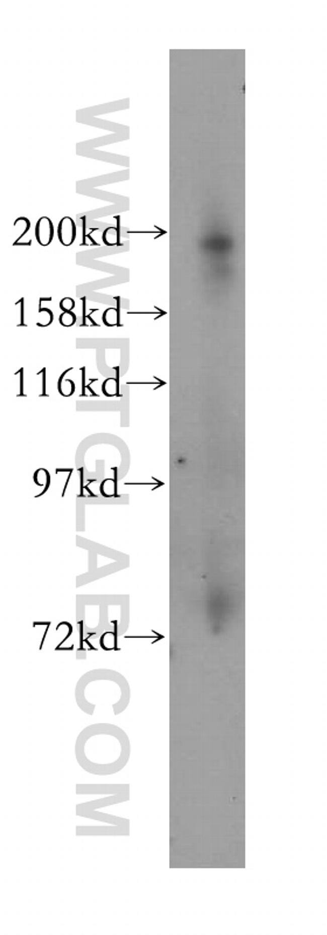 KIF1B Antibody in Western Blot (WB)