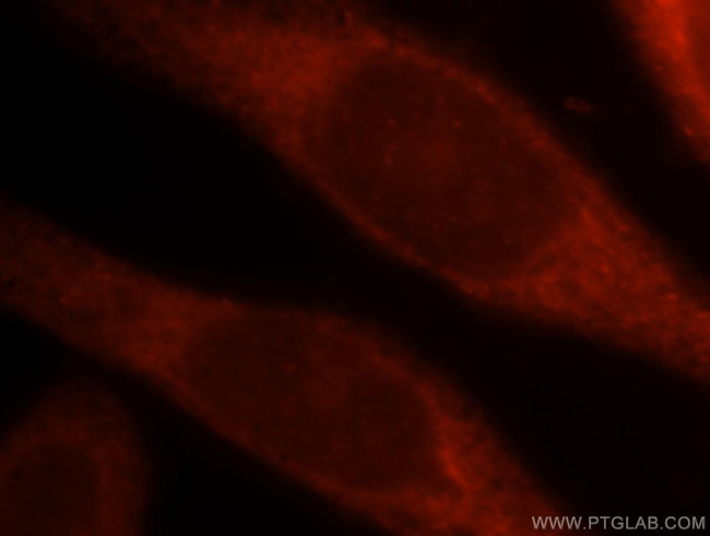 Adenylosuccinate lyase Antibody in Immunocytochemistry (ICC/IF)